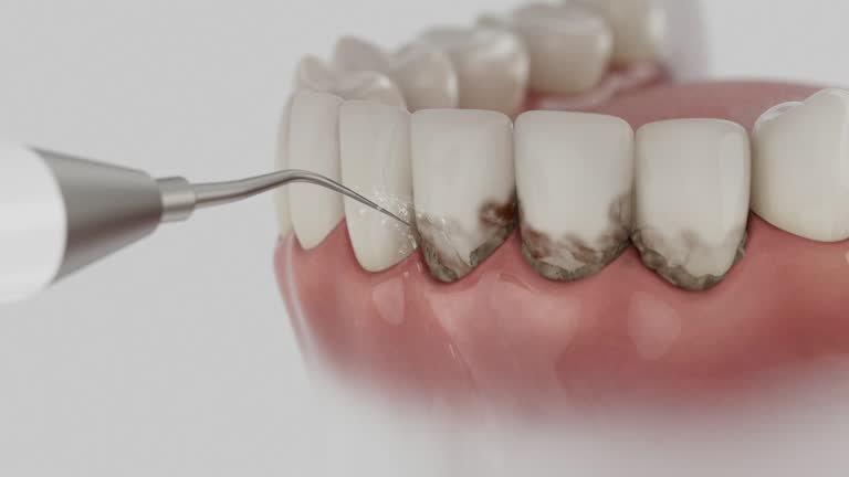 Reliable Root Canal Treatment contractor in Swain County County, NC by Dentist Open Now